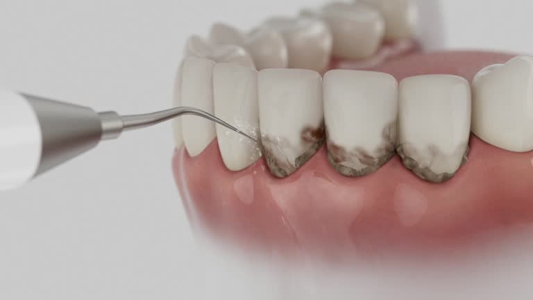 Trusted Dental Implants service in Philadelphia, PA - Dentist Open Now